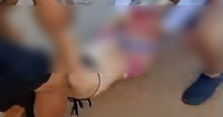 video:-jovem-e-atacada-por-tubarao-e-tem-perna-devorada-em-praia-de-pernambuco
