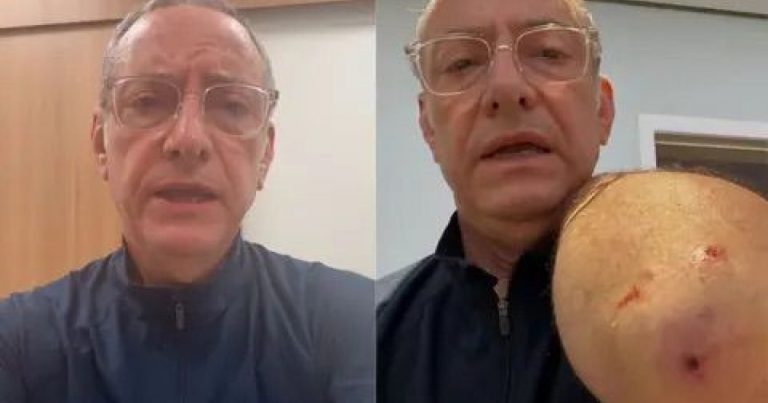 video:-apresentador-jose-roberto-burnier-leva-quatro-pontos-apos-ataque-de-pitbull-em-sao-paulo
