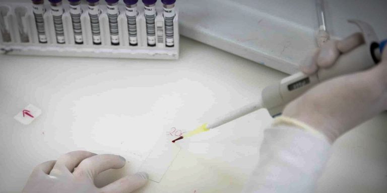 Secretaria de Saúde de SP investiga novo caso suspeito de ebola secretaria-de-saude-de-sp-investiga-novo-caso-suspeito-de-ebola