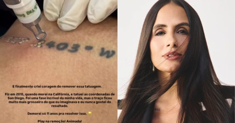 carol-peixinho-compartilha-processo-de-remocao-de-tatuagem