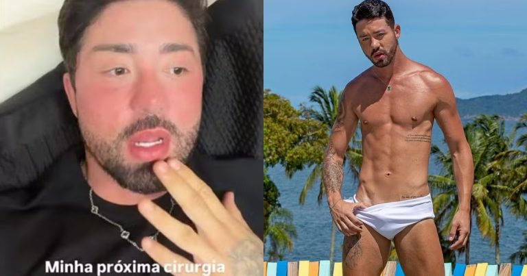 rico-melquiades-revela-que-sera-submetido-a-harmonizacao-anal:-“deixa-lisinho”